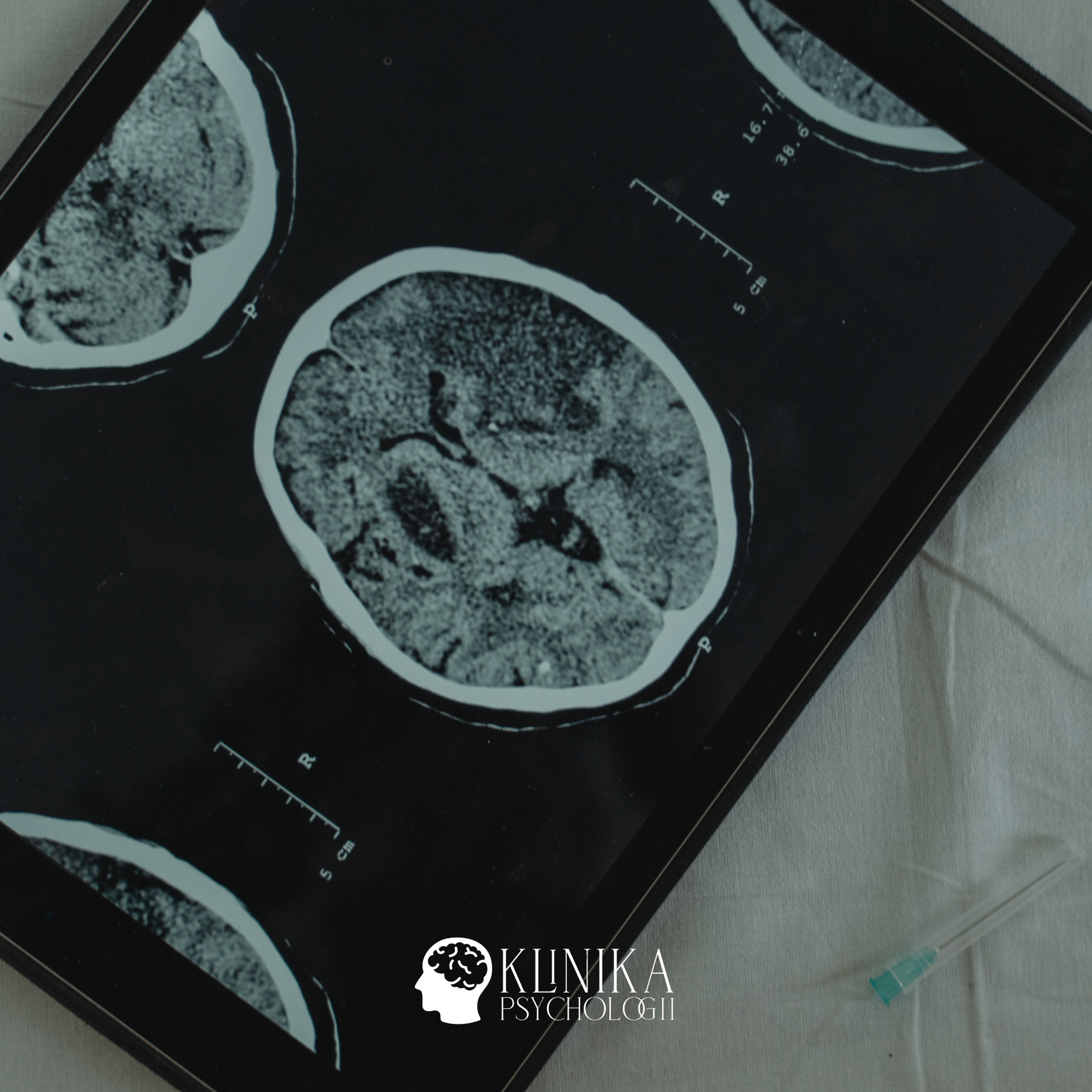 Jak mózg odbiera i&nbsp;przetwarza emocje